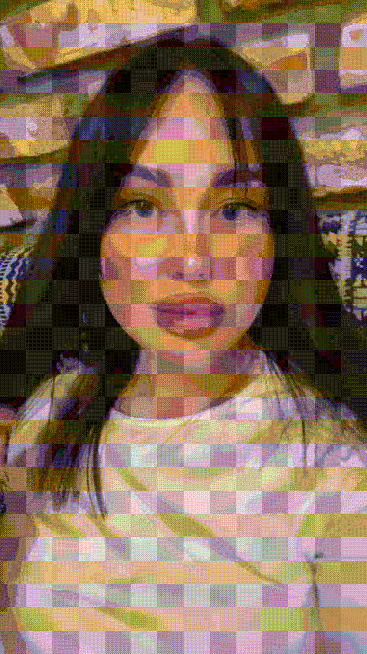 Прикрепление